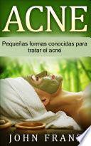 Acné
