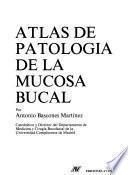 Atlas de patología de la mucosa bucal