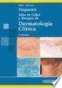 Atlas en color y sinopsis de dermatologia clinica / Fitzpatrick's Color atlas and synopsis of clinical dermatology