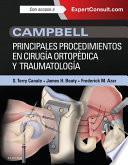 Campbell. Principales procedimientos en cirugía ortopédica y traumatología + ExpertConsult
