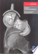 Choque femoroacetabular