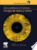 Cirugía de retina y vítreo + DVD-ROM