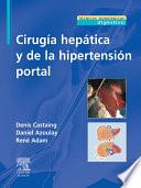 Cirugía hepática y de la hipertensión portal