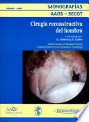 Cirugía reconstructiva del hombro