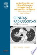 Clínicas Radiológicas de Norteamérica 2007. Volumen 45 no 1: Actualización en diagnóstico por imagen de las neoplasias malignas