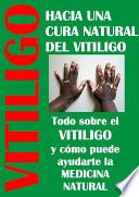Cura para el vitiligo