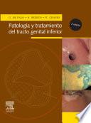 De Palo, G., Patología y tratamiento del tracto genital inferior, 2a ed. ©2007