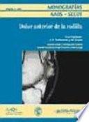 Dolor anterior de la rodilla