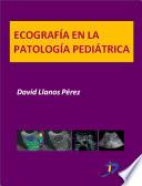 Ecografía en la patología pediátrica