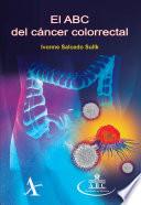El ABC del cáncer colorrectal