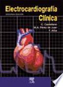 Electrocardiografía Clínica