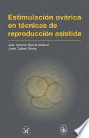 Estimulación ovárica en técnicas de reproducción asistida