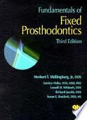 Fundamentals of Fixed Prosthodontics