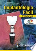 Implantología Fácil