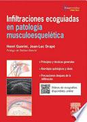 Infiltraciones ecoguiadas en patología musculoesquelética