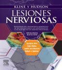 Kline y Hudson. Lesiones nerviosas, 2a ed.