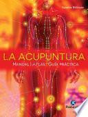 La acupuntura