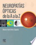 Neuropatías Ópticas de la A A La Z