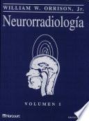 Neurorradiología