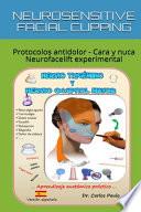 NEUROSENSITIVE FACIAL CUPPING - spanish