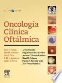 Oncología clínica oftálmica