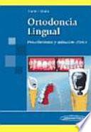 Ortodoncia Lingual/ Lingual Orthodontics