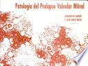 Patologia Del Prolapso Valvular