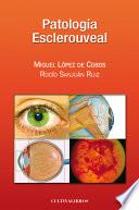 Patología Esclerouveal