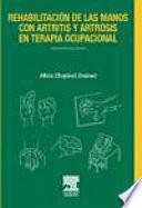 Rehabilitación de las manos con artritis y artrosis en terapia ocupacional