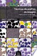 Técnicas de análisis de imagen