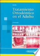 Tratamiento Ortodón. Adul. 2Ed.-e