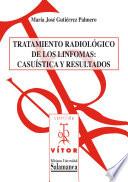 Tratamiento radiológico de los linfomas:Casuística y resultados