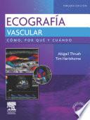 Ultrasonido vascular. Cómo, por qué y cuándo + DVD-ROM 3 ed. © 2010