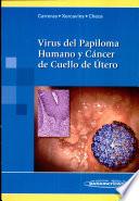 Virus del papiloma humano y cáncer de cuello de útero