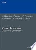 Visión binocular. Diagnóstico y tratamiento